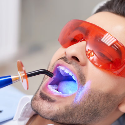 young-man-getting-teeth-whitening-at-dentist